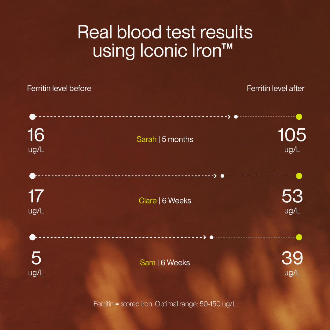 Iconic Iron™